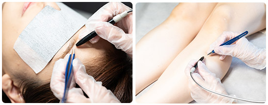 女性のための脱毛サロン